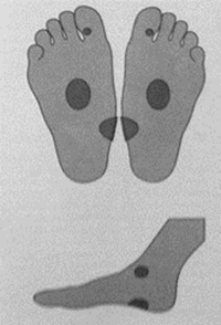 Описание: Массаж стоп при отравлении